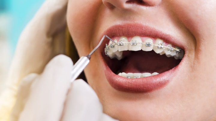 Saúde Bucal e Estética: O que o Makeup Your Styles Descobriu sobre o Sorriso como Parte da Rotina de Beleza