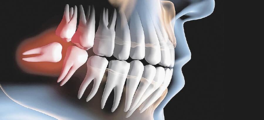 Descubra Como Funciona a Cirurgia