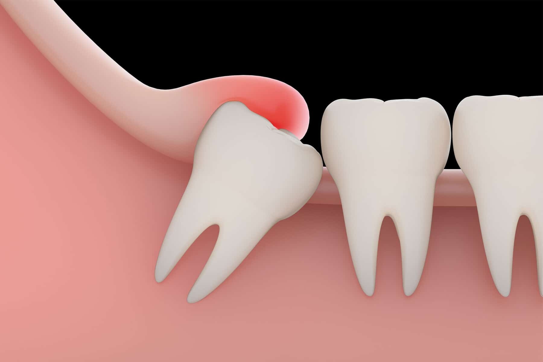 Descubra Como Funciona a Cirurgia